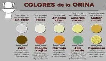 Chequea todo lo que debes conocer sobre el  color de tu orina para saber como anda tu salud