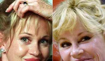 Melanie Griffith: las cirugías me estropearon el rostro: "Me veo más natural ahora