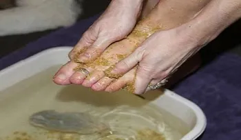 El increíble remedio para curar las varices, los callos y talones en solo 10 días