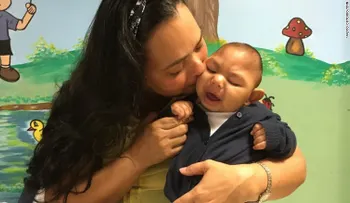 El virus del zika multiplica los devastadores defectos de nacimiento en Brasil