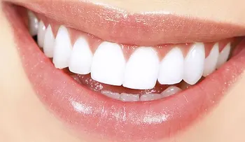El arte de las sonrisas perfectas: Diseño de sonrisa