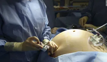 ¿Debe ser obligatoria la terapia para pacientes que se someten a cirugía de pérdida de peso?