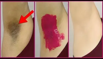 Por qué no me lo dijeron antes: blanquea tus axilas en 10 minutos con este simple remedio