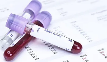 Un análisis de sangre detecta tumores 4 años antes que métodos convencionales
