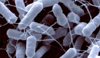  Ministerio de Salud alerta posible entrada desde Haití de fórmula láctea infantil con salmonella agona 