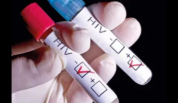  Desarrollan un nuevo método oral  "más sensible" para detectar el VIH