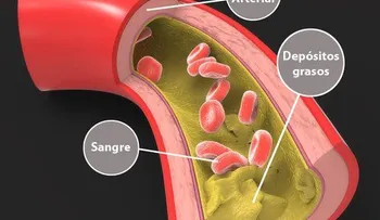 Cómo bajar los triglicéridos de forma natural