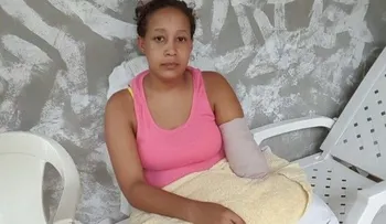 Apresan hombre cercenó brazo a su expareja			