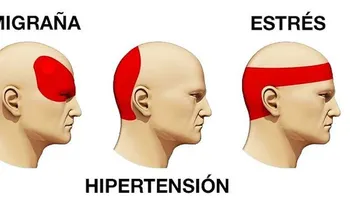 Esto calma cualquier dolor de cabeza por fuerte que sea en 6 minutos sin medicamentos