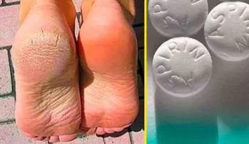Quita la dureza de los pies con Aspirina: SORPRENDENTE 
