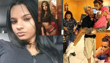 Así quedó esta jovencita luego de una cirugía de aumento de seno