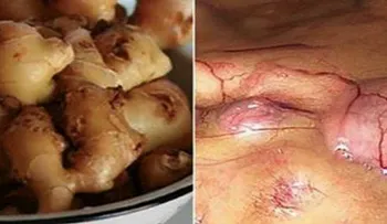 Esto le pasa a tu cuerpo si si come jengibre 30 días