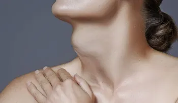 Qué es el bocio; causa que lo produce (VIDEO)