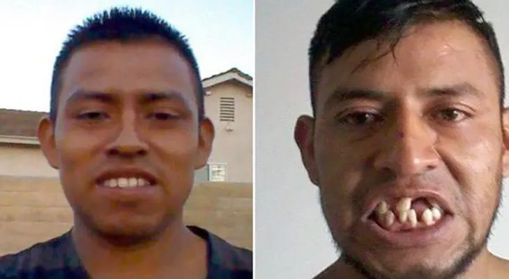 Cómo un futbolista despertó del coma sin dientes y con una deuda de 105.000 dólares