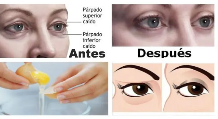 Sabes cómo levantar los párpados caídos de forma natural, fácil  rapido...