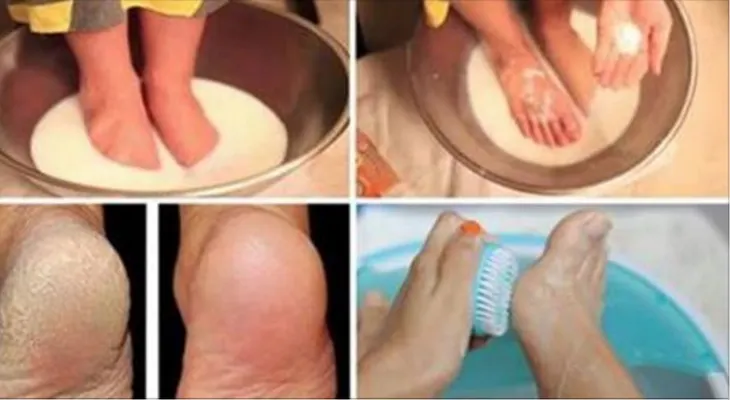No botes más dinero en pedicura; conserva tus pies perfectos con estos dos ingredientes