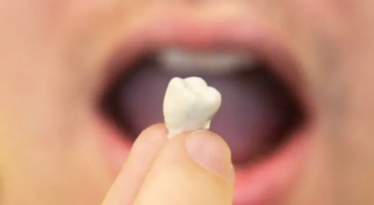 La sorprendente razón por la que sueñas que se te caen los dientes