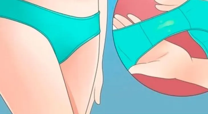 Remedios caseros para el flujo vaginal