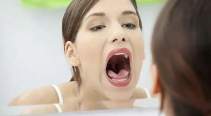 Evita el sarro en tu boca