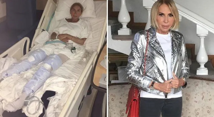 Laura Bozzo: Pasé seis meses de terror, me cortaron parte del intestino y me dejaron un hueco en la barriga 