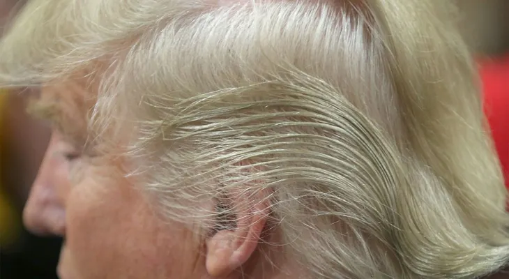 Donald Trump y los peligrosos efectos de la medina que toma para evitar la caída del cabello