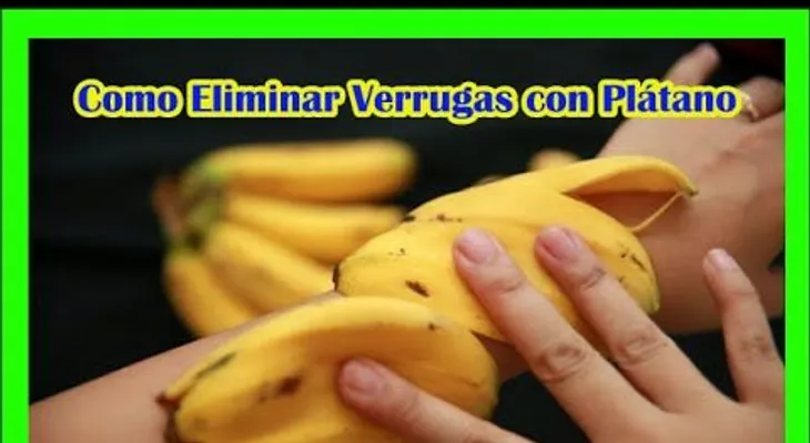 Entérate beneficios cáscara de plátano para arrugas, verrugas, psoriasis...!