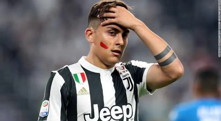 Estrellas del fútbol italiano usaron lápiz labial para esta campaña
