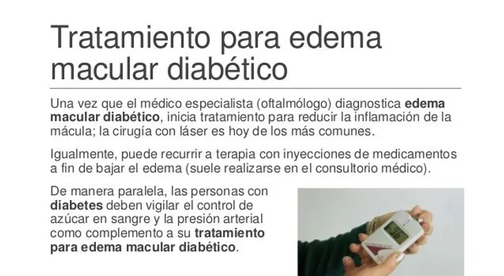 Edema Macular Diabético: Una de las principales causas de ceguera en los adultos con diabetes