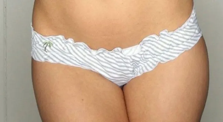 6 problemas vaginales más comunes de lo que te imaginas
