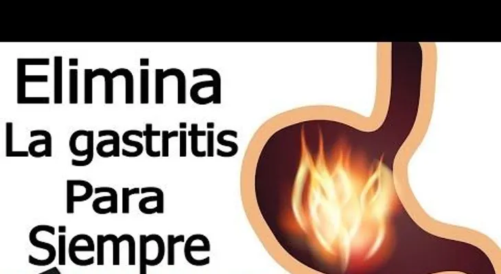 Si sufre de gastritis o de acidez este eficaz remedio es la solución: Agua de coco, papa cruda, te de linaza y agua de limón