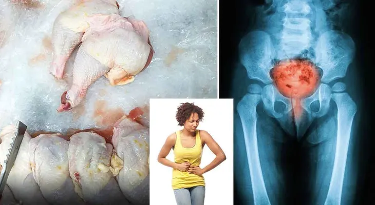Este tipo de pollo está relacionado con la epidemia de infección del tracto urinario