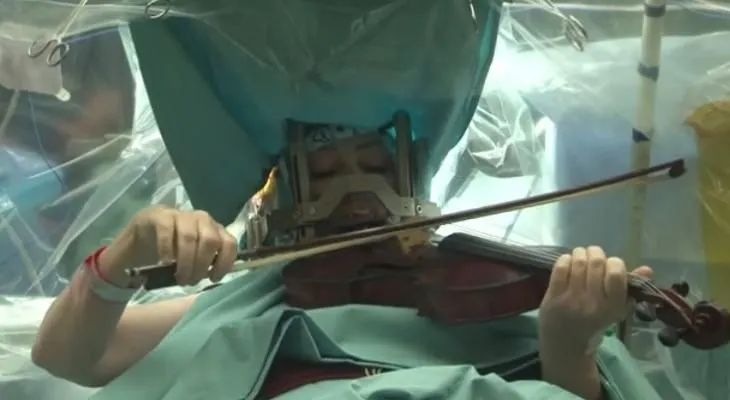 Video: Una mujer toca violín durante su cirugía de cerebro