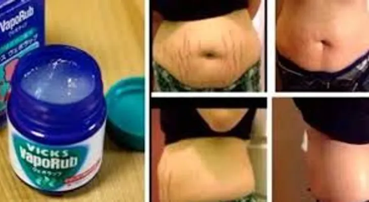 Si nadie te lo había dicho, conoce los usos del ungüento milagroso