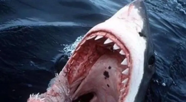 Australia: Surfista pierde la pierna por ataque de tiburón