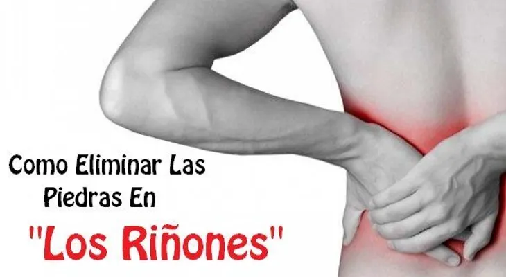 Remedio para eliminar las piedras en los riñones