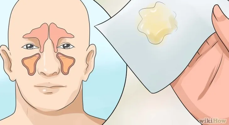 Libera tus pulmones de mocos ¡PRUEBA ESTO!