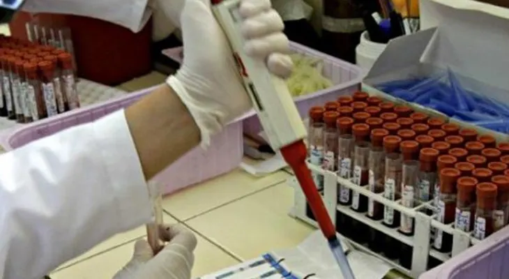 Laboratorista contagió por 10 años a pacientes con hepatitis C