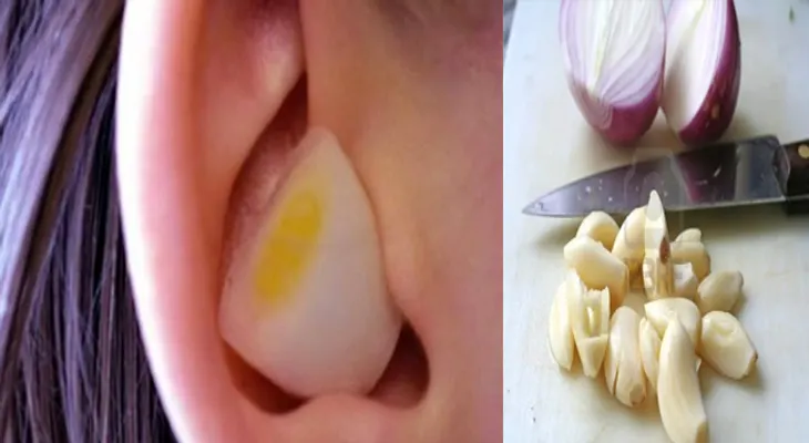 ¿Por qué deberías colocarte un trozo de ajo y cebolla en tu oreja?