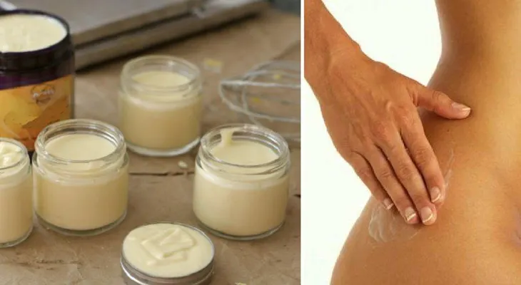 Estaba frustrada al no poder eliminar mis estrías; ahora recomiendo esta crema natural a todas mis amigas