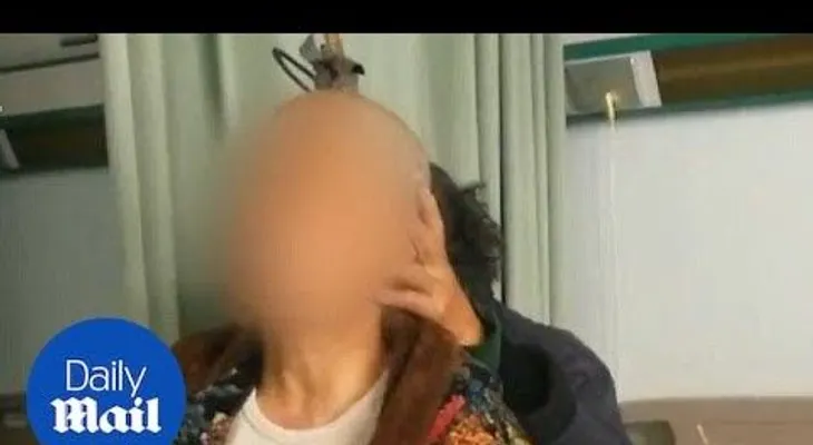 Una mujer acude al hospital en autobús con unas enormes tijeras clavadas en la cabeza (18+)