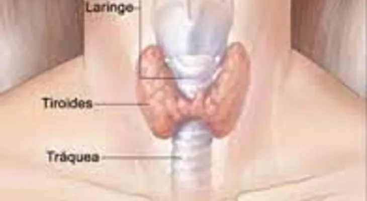 El remedio que cura la glándula tiroides