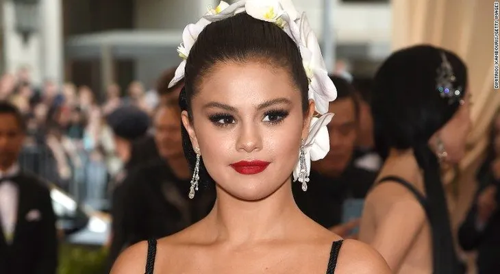 Selena Gomez revela tiene lupus: ¿Qué es esa enfermedad y cómo se trata?