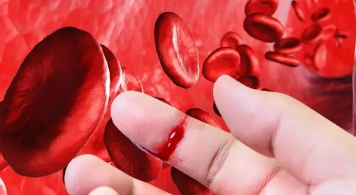 Sin tratamiento la vida con hemofilia se torna casi imposible, dicen expertos