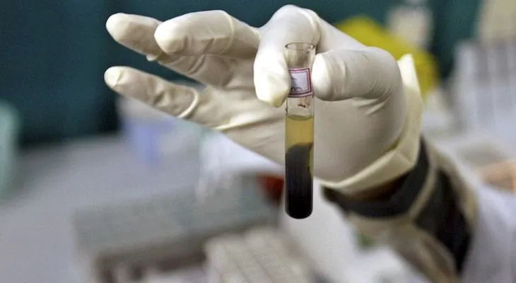 Descubren agentes que neutralizan al VIH