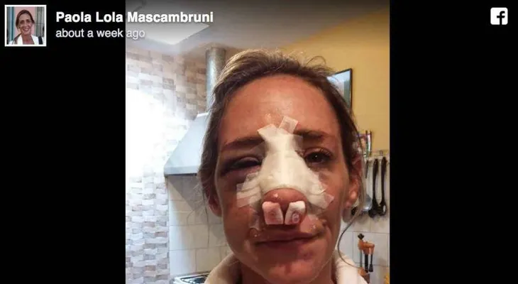 Esta mujer vivió una pesadilla por volver con su ex pareja violenta y lo cuenta para que a otras no pasen por la misma situación 