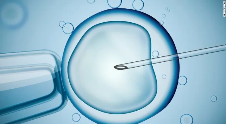 26 mujeres pudieron haber sido inseminadas con el esperma incorrecto en Holanda