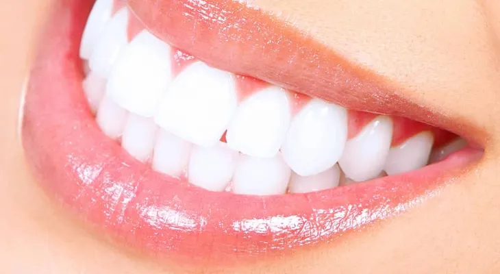 Una receta imperdible para eliminar el sarro y blanquea tus dientes en 15 minutos
