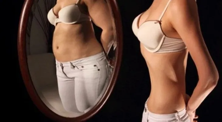  La anorexia: Una enfermedad que te desnutre y te puede dejar en los huesos 