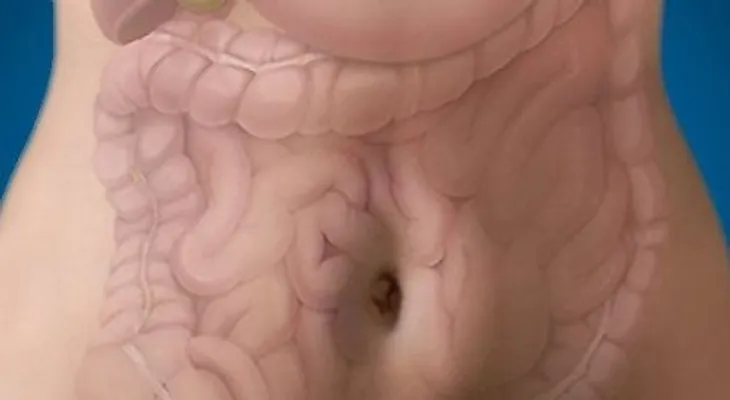  La enfermedad inflamatoria intestinal (EII): un dolor silencioso no curable