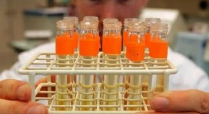 Descubren célula inmunitaria con potencial contra la diabetes de tipo 1 
